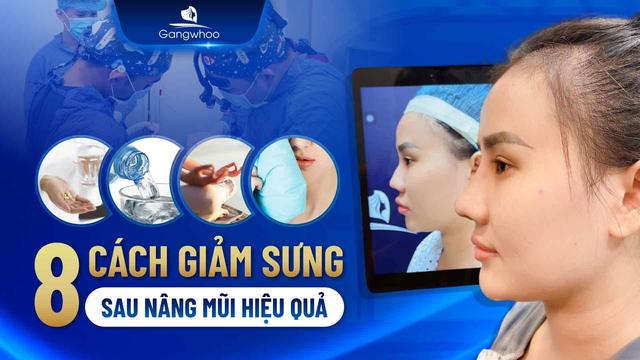 cách giảm sưng sau nâng mũi
