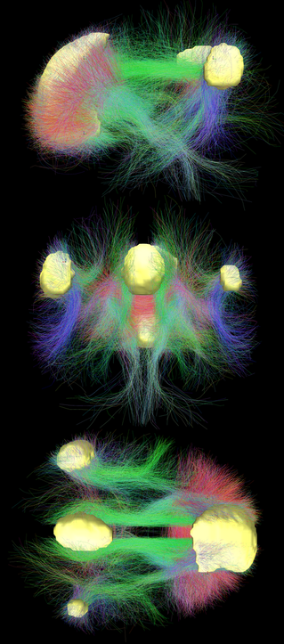 Default mode network connectivity. This image shows main regions of the default mode network (yellow) and connectivity between the regions color-coded by structural traversing direction. Source: Wikimedia Commonsꜛ (license: CC BY-SA 4.0).