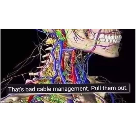 a skull with all it's nerves and vains "that's bad cable management. Pull them out."