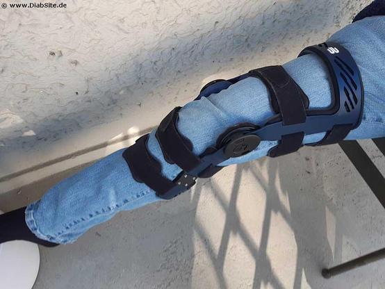 Diabetes und Arthrose sowie Knie- und Hüftgeleksersatz. 