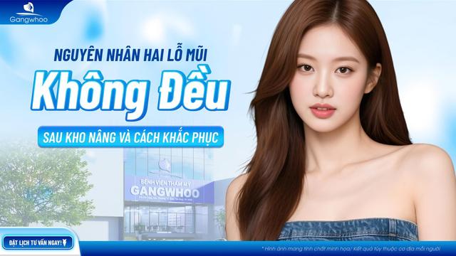 hai lỗ mũi không đều sau khi nâng