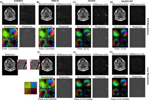 Figure from the publication showing MRI images of the jaw region, coil sensitivities, and projection tests for various methods.