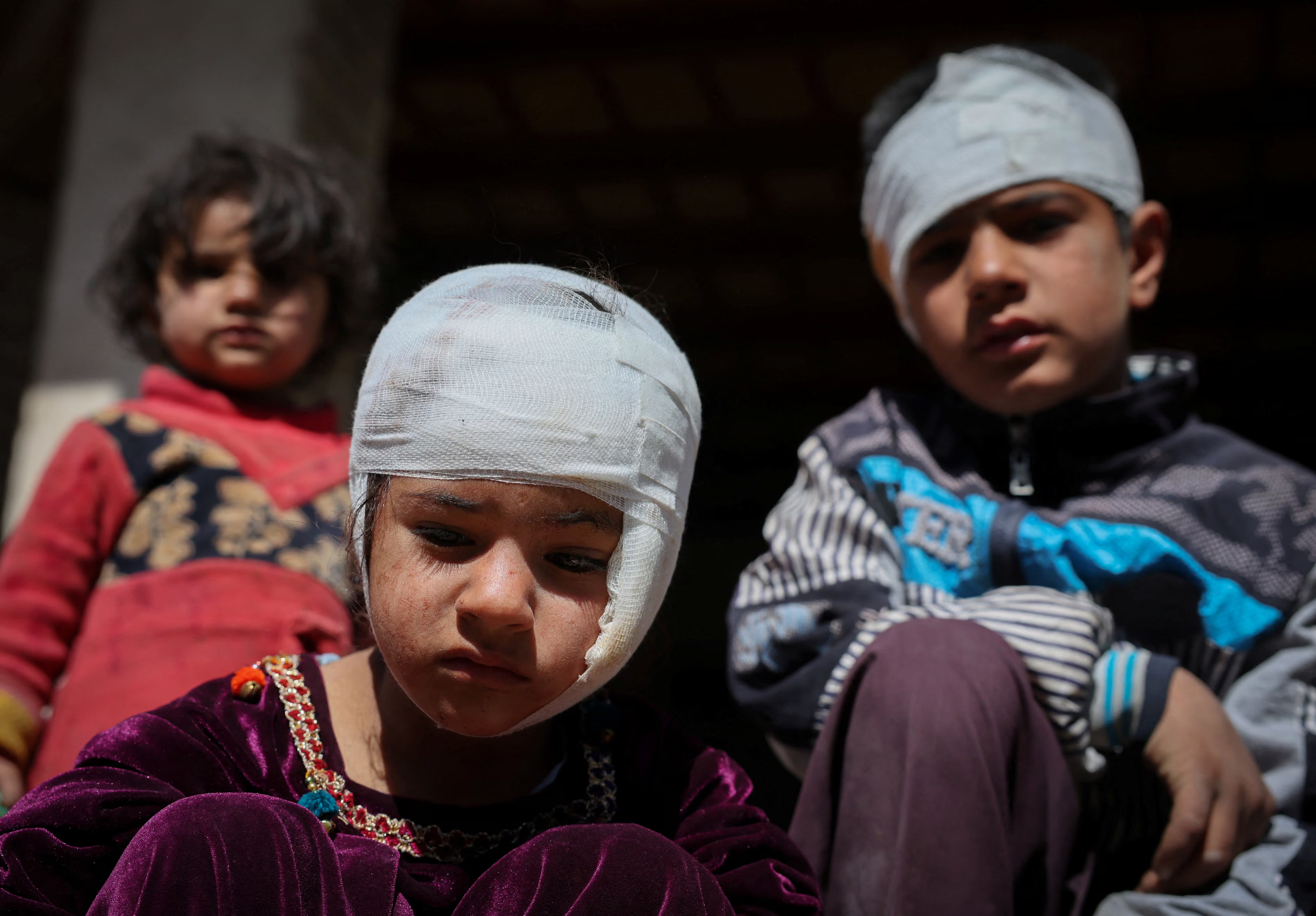 Two children with bandaged heads.