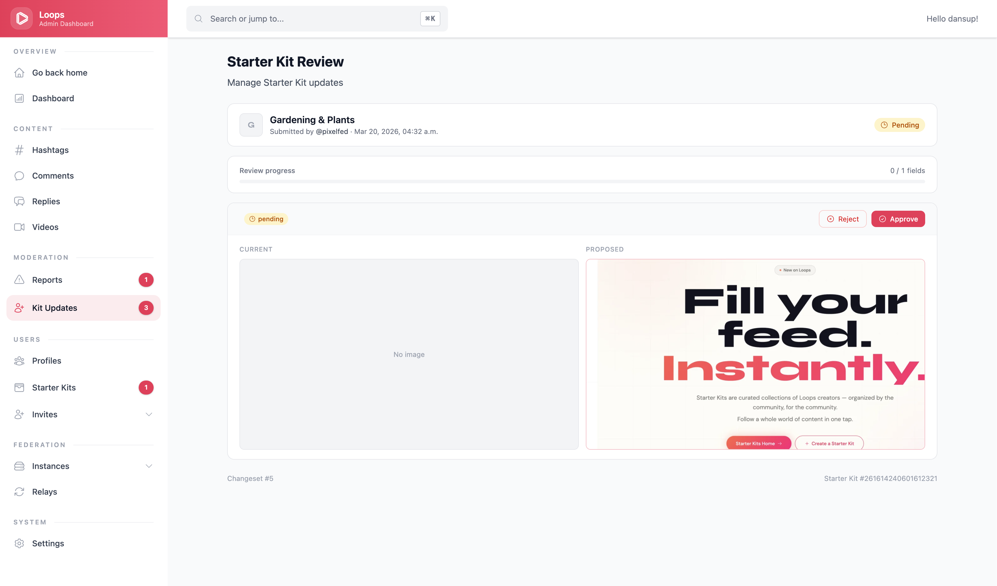 Loops Starter Kit Admin Dashboard Review