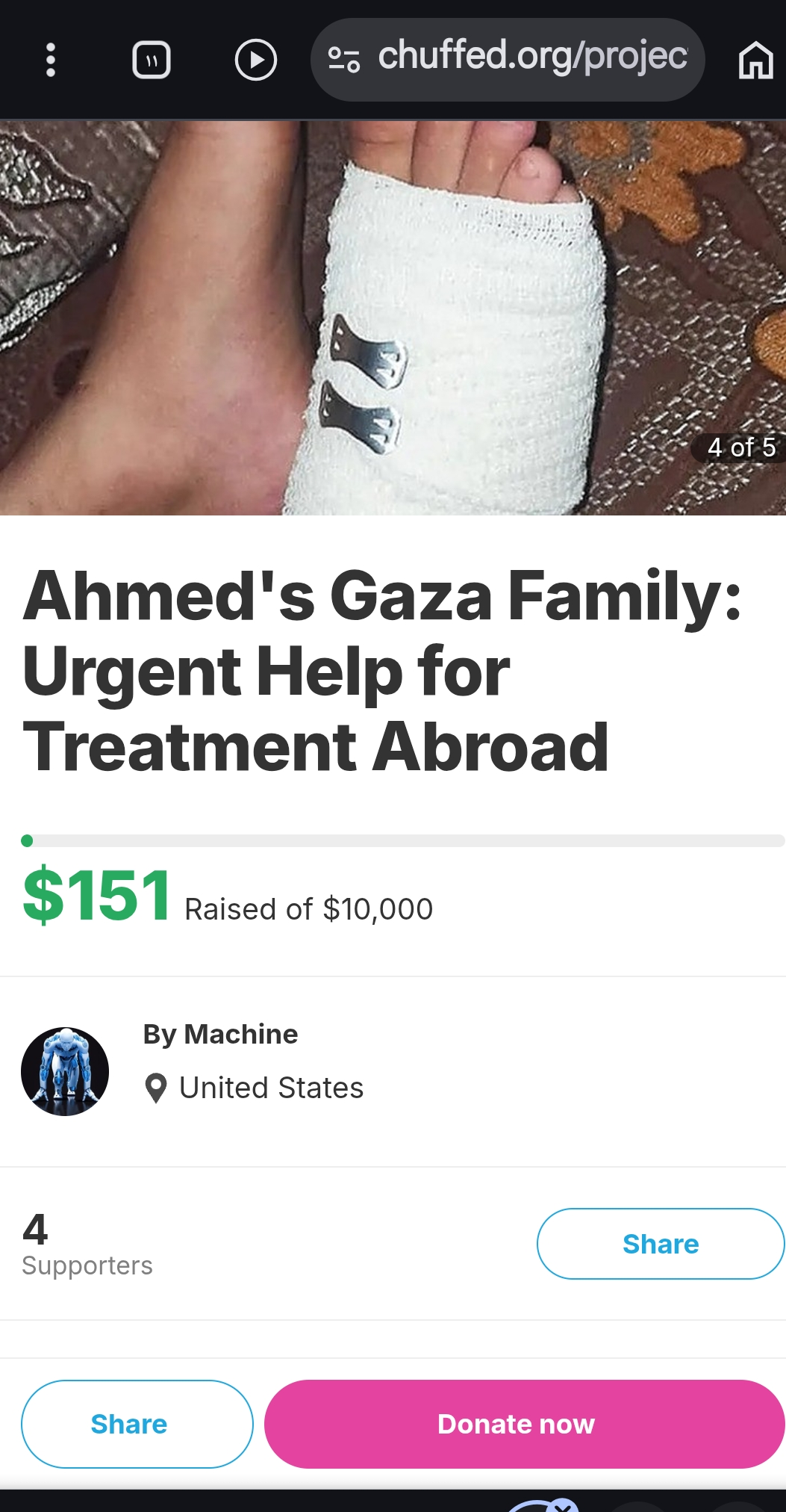 Need treatment