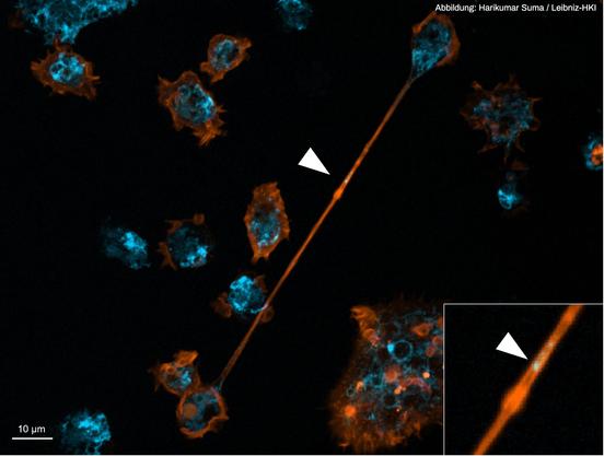 Posted media