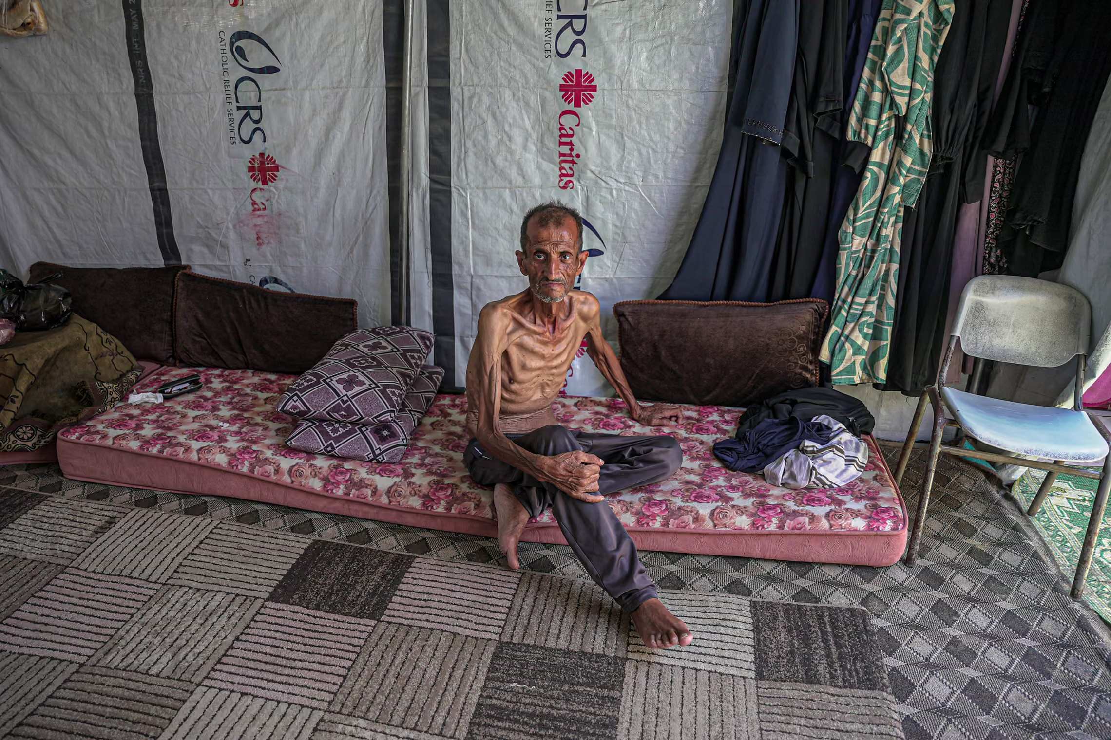A severely malnourished 61-year-old man sits in a tent.