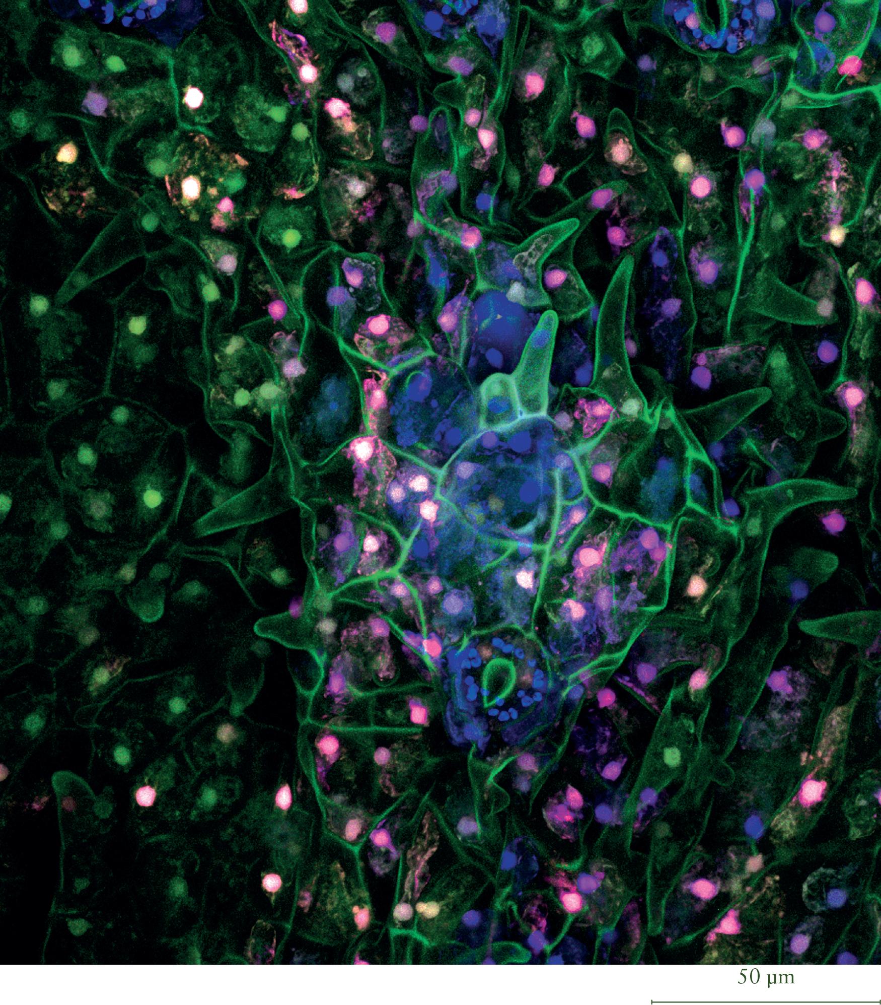 Psychotria viridis (chacruna); confocal image.