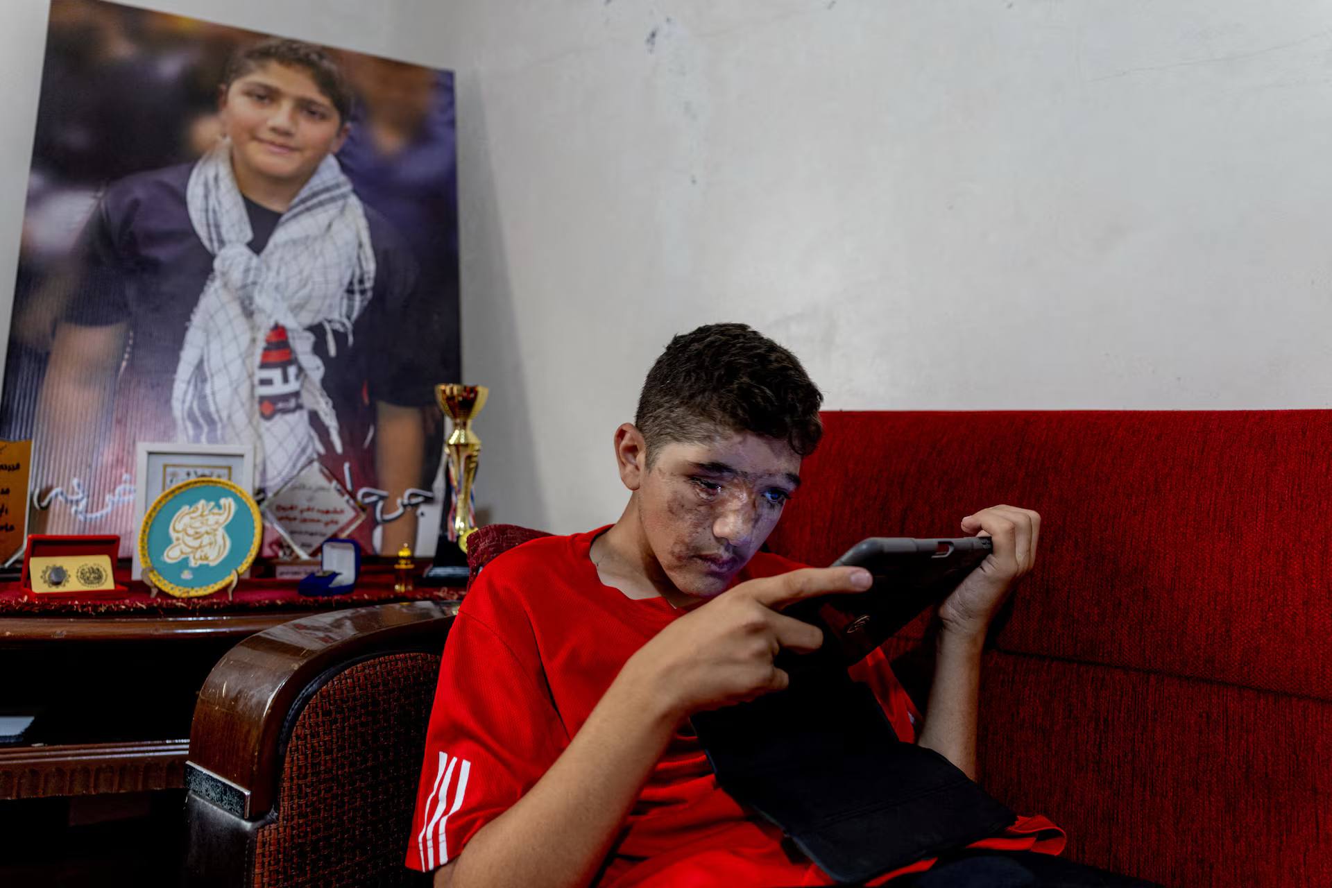 Ali Abbas, 14, who lost his right eye with severe damage to his right lower eyelid and lost some fingers in pager attacks across Lebanon two years ago, sits beside a portrait of himself taken before he was injured.